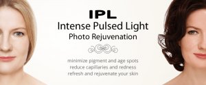 ipl-intense-pulsed-light-c